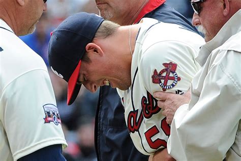 This pitcher broke his elbow throwing a pitch