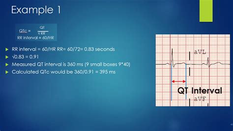 Qtc Interval