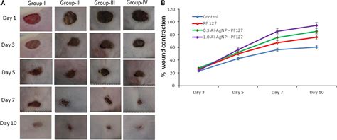 Frontiers | Synthesis, Characterization, Antibacterial and Wound Healing Efficacy of Silver ...