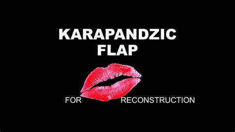 KARAPANDZIC FLAP FOR LIP RECONSTRUCTION - YouTube