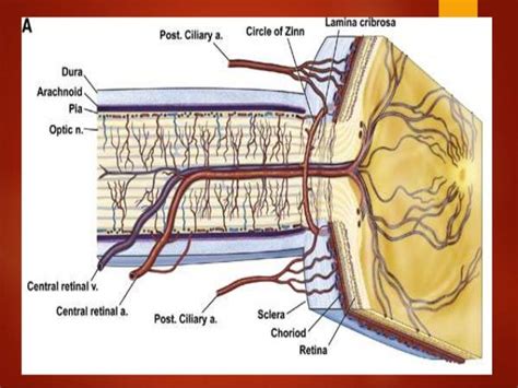 Anatomy of optic nerve (Optic Nerve Anatomy), Blood Supply & Clinical…