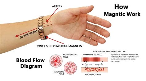 What is Magnetic Therapy