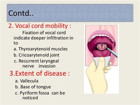 Diagnosis and treatment of carcinoma of larynx by nitesh Kr.