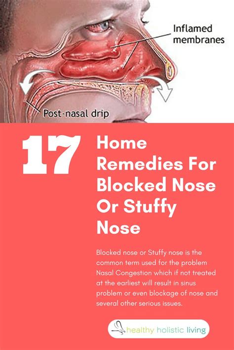 Blocked nose or Stuffy nose is the common term used for the problem Nasal Congestion which if ...