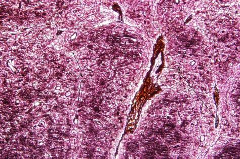 Reticular Fibers, Tendon, Elastic Lamina, and Adipose Tissue