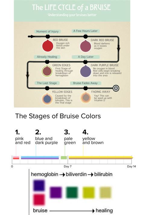 bruise stages – Georgia Middleton