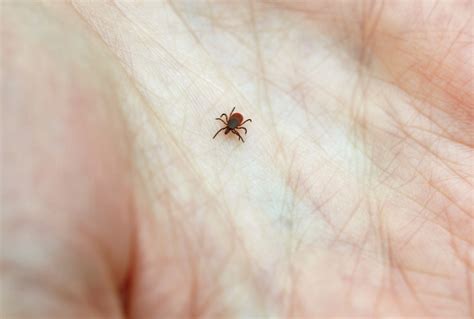 Did You Get Bit By A Lyme-Infested Tick? Here's What To Do | WBUR