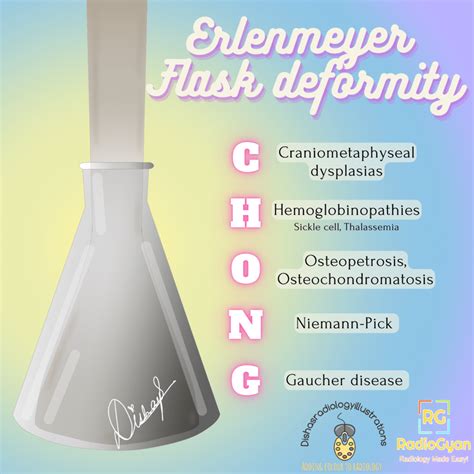 Causes Of Erlenmeyer Flask Deformity - Visual Mnemonics - RadioGyan