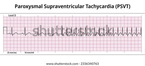 3 Psvt Heart Images, Stock Photos, 3D objects, & Vectors | Shutterstock