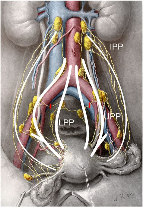 Pelvic lymph nodes - virginkesil