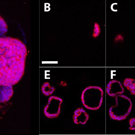 Morphology of MCF-7 cells grown in 2D and 3D cultures. MCF-7 human ...