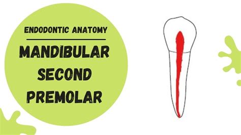 2nd Mandibular Premolar Root Canal Anatomy | Porn Sex Picture