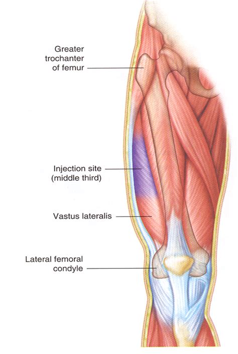 vastus lateralis intramuscular injection site | Nursing school tips ...