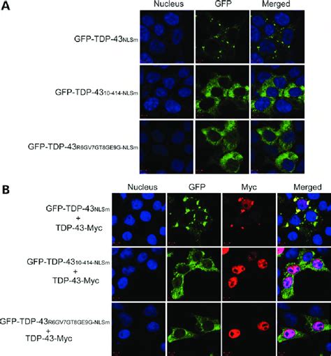 The extreme N-terminus of TDP-43 is required for aggregation of ...