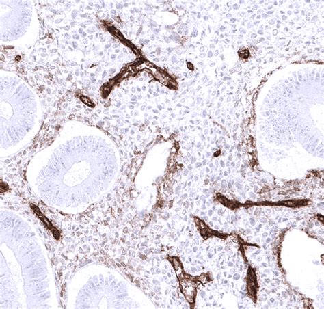 CD34 Recombinant Antibody AE00355 - Aeonian Biotech