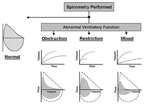 MEDICAL SCHOOL: SPIROMETRY INTERPRETATION | Medical information, Asthma ...