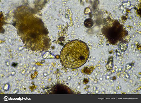 Arcella Testate Amoebae Microscope Soil Sample Farm Living Soil Regenerative Stock Photo by ...