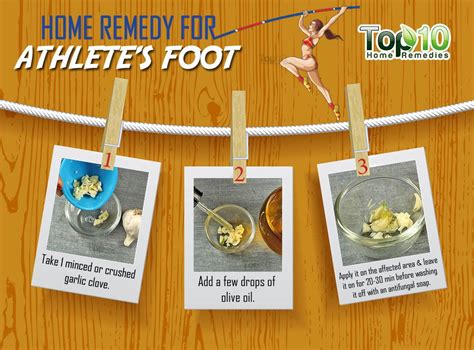 Home Remedies for Athlete’s Foot | Top 10 Home Remedies