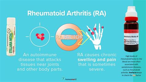 Homeopathy Medicine List for Arthritis, buy online get upto 15% off