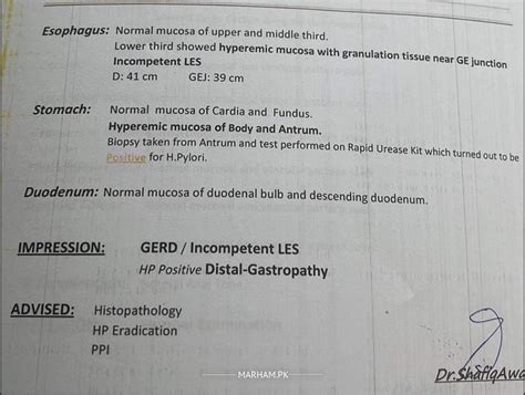 Ask a Gastroenterologist Online for H Pylori Endoscopy.