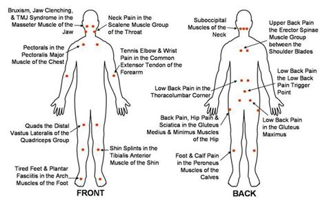 Trigger Point Chart – Jolt Therapy Tool