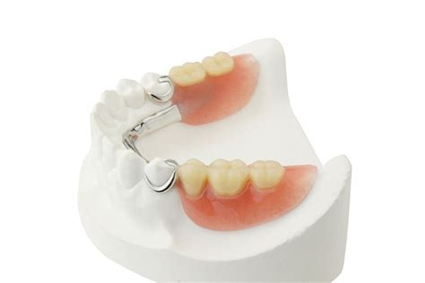 Removable Partial Denture (RPD) - Dreamland Dental & Orthodontics