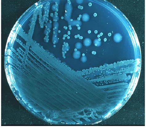 Pseudomonas aeruginosa ATCC 9027 - AGROTEKNO LAB