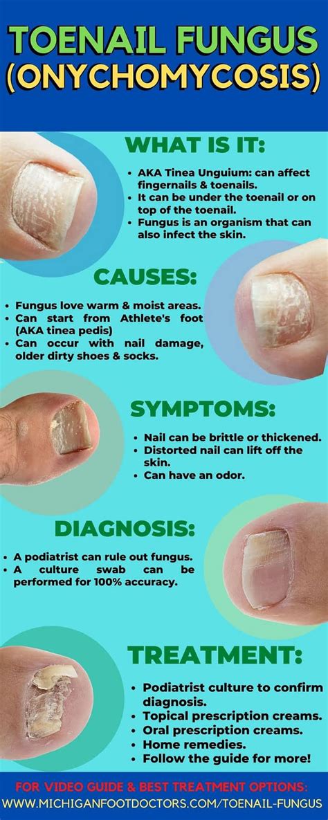 proclearz toenail fungus - Toenail Fungus Treatment | Toenail Fungus Treatment