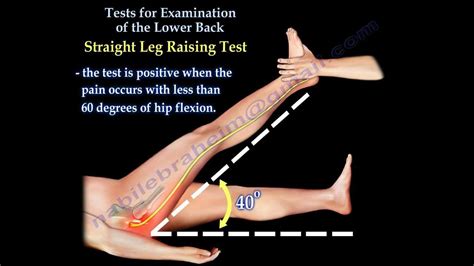 Tests For Examination Of The Lower Back - Everything You Need To Know - Dr. Nabil Ebraheim - YouTube