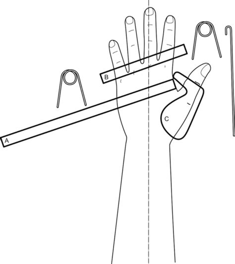 Guide Functional ulnar nerve splint and combined ulnar median nerve splint