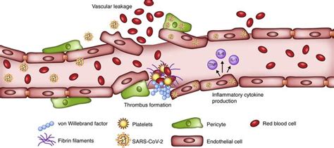 JCI Insight - Cardiovascular complications of COVID-19