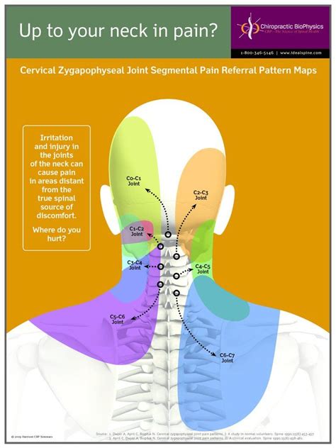 Neck Pain Sclerotome – Chiropractic BioPhysics | Yoga anatomie, Anatomie und physiologie ...