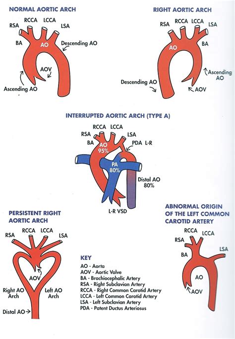 |Cost of aortic and mitral valves of the heart|. |enlarged lymphnodes para aortic mesenteric ...