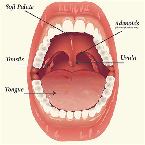 See adenoidectomy and Adenoids conditions - Fitness MG