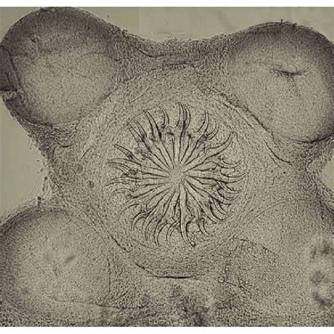 The scolex has four cup shaped suckers and bears a rostellum which has... | Download Scientific ...