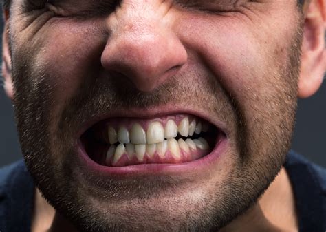 Guard yourself from Grinding your Teeth | Conroe, TX