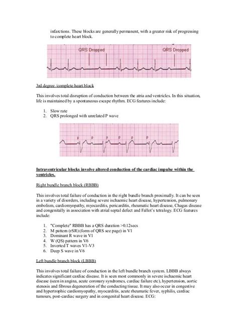 Beginners Guide for ECG Interpretation