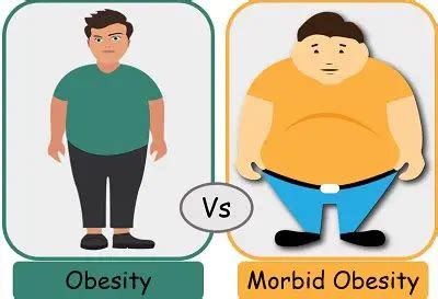 Difference Between Obesity and Morbid Obesity (with Comparison Chart ...