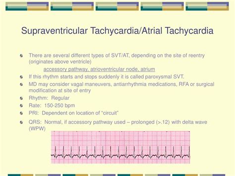 Supraventricular Atrial Tachycardia