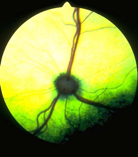 Retina: progressive retinal atrophy 02 - normal fundus in littermate control in Cats (Felis ...