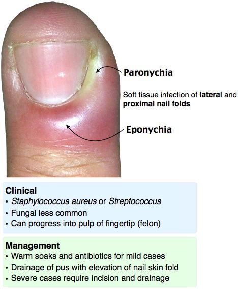 Rosh Review | Medical knowledge, Medical studies, Emergency medicine