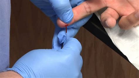 Phlebotomy: Dermal Capillary Punctures | Blood Collection (Rx-TN) - YouTube