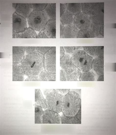 lab practical image 3 - stages of mitosis Diagram | Quizlet