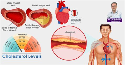 High cholesterol and triglycerides Risk and ways to Control | Collegenp