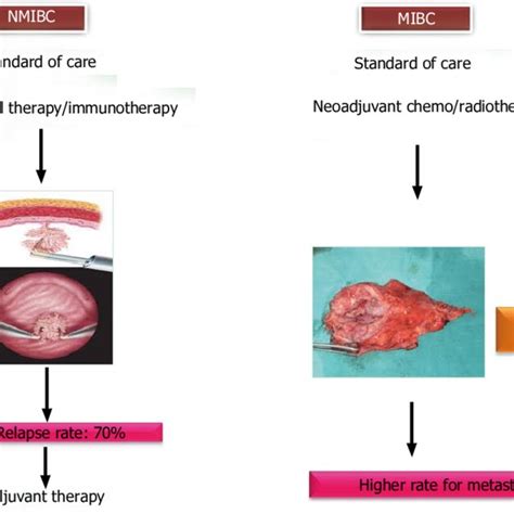 Staging, grading and prognosis of urothelial carcinoma of the bladder. | Download Scientific Diagram