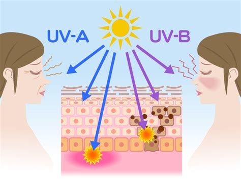 UV-Induced Free Radical Effects on the Skin: Skin Aging Explained