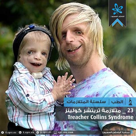 Celebrities With Turner Syndrome