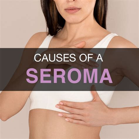 Seroma Scares? No More! Safe & Natural Supplements Surgery Recovery