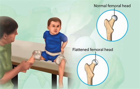 Health Condition : Symptoms, Causes, Treatment and More