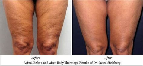 5 Ways To Improve The Look Of Your Legs | Justinboey